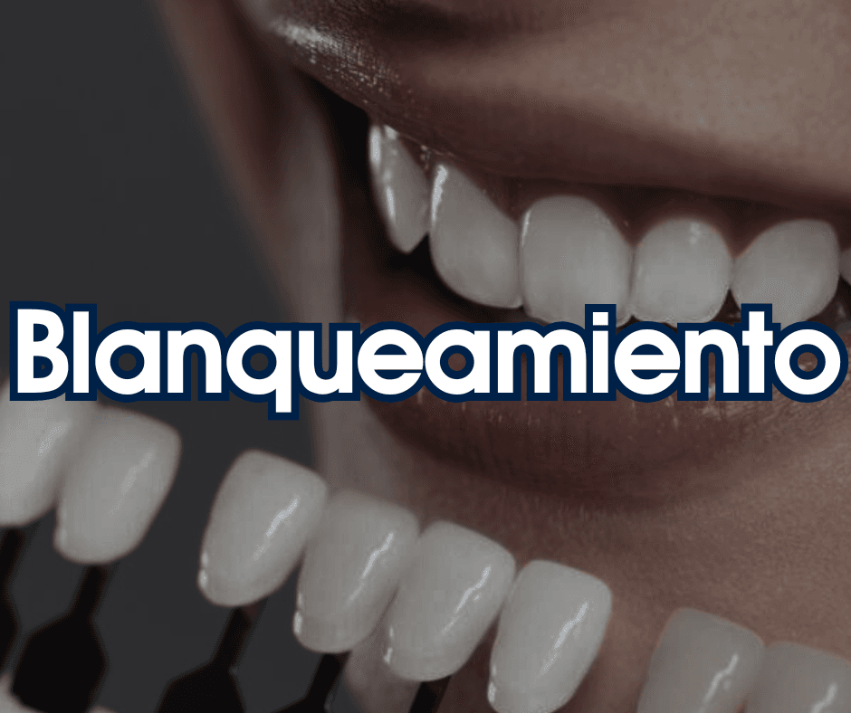 Blanqueamiento